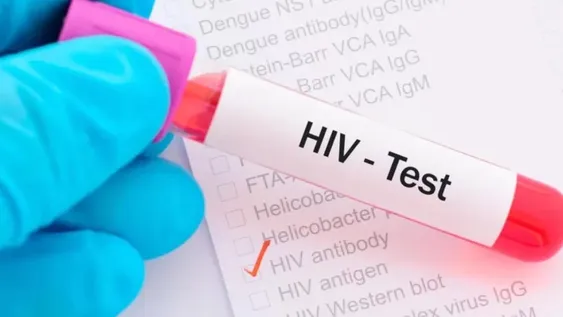 Una inyección cada 2 meses, la nueva apuesta contra el VIH