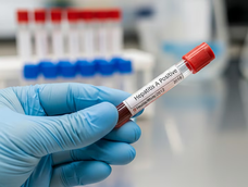 hepatitis en san juan: dos anos sin casos de tipo a y un promedio de 75 diagnosticos de la variante b y c