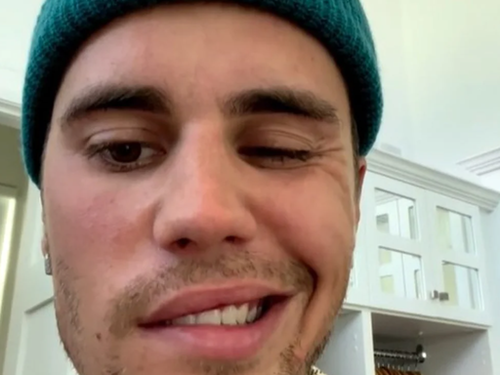 Con media cara paralizada por un virus, Justin Bieber cancela varios shows de su gira