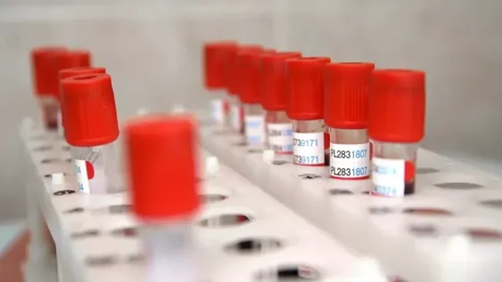 Rusia anunció la fecha de registro de la primera vacuna contra el coronavirus