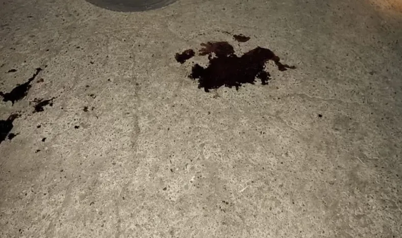 Un joven fue atropellado por un tren y sufrió heridas muy graves