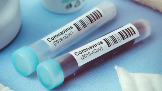 Se registraron 327 casos positivos de coronavirus y 7 muertes en las últimas 24 horas del país