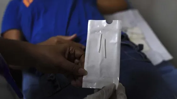 El implante subdérmico crece 1.500% y baja el embarazo adolescente