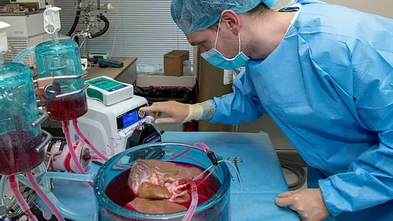 A pesar de la pandemia, hicieron más de 1.700 trasplantes en 2020