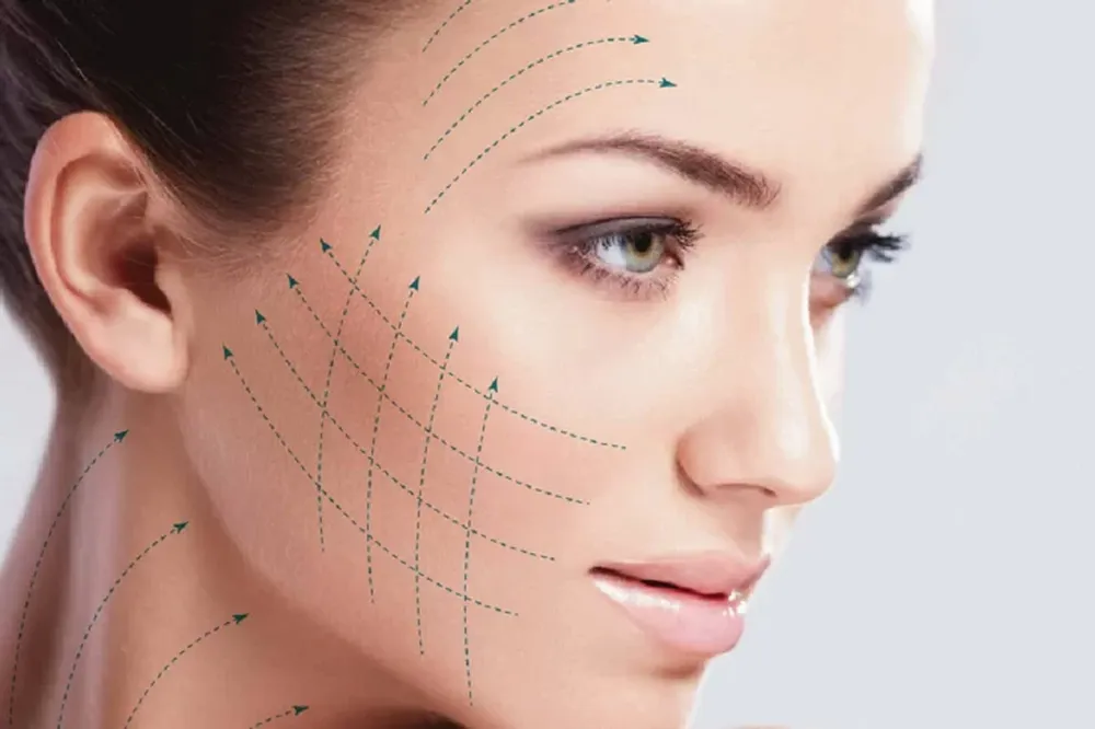 Hilos tensores, la solución para verse joven