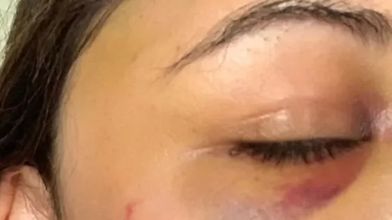 Dos hombres ingresaron a su casa y la golpearon para robarle, la salvaron sus gritos