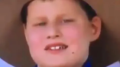 “El niño sapo” que se hizo viral por comer moscas durante una entrevista en televisión