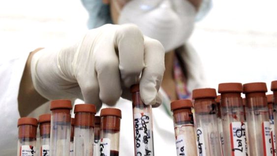 Esperanza en los avances sobre Sida por el caso de una argentina