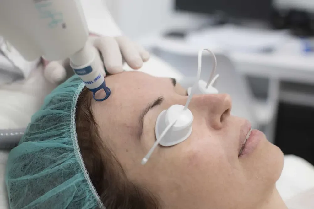 El tratamiento con láser CO2