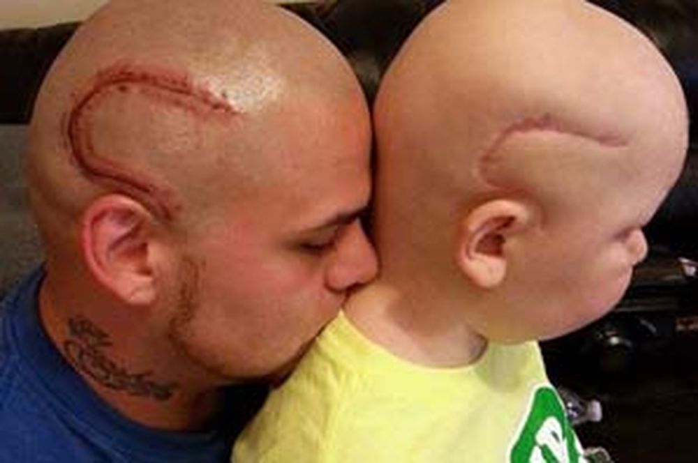 Se tatuó una cicatriz en la cabeza para animar a su hijo enfermo