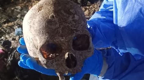 Aberrante hallazgo en un basural de Albardón: encontraron un cráneo y buscan determinar si otros restos son humanos