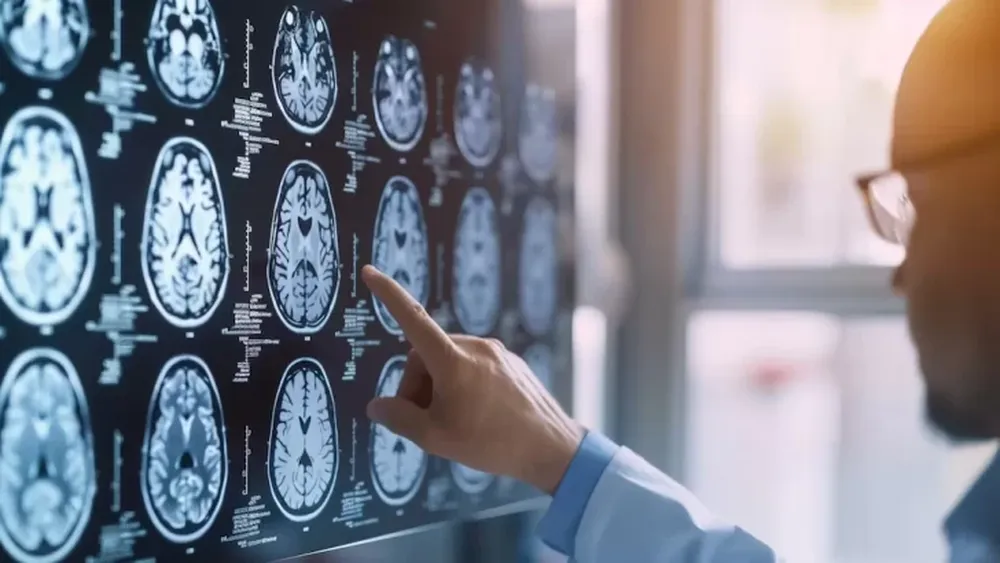 Cómo prevenir la migraña: 10 alimentos que deberías evitar