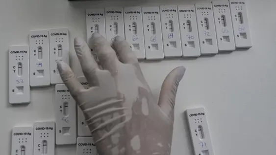 Cae la curva: en febrero hubo 92% menos casos que enero, el peor mes en pandemia