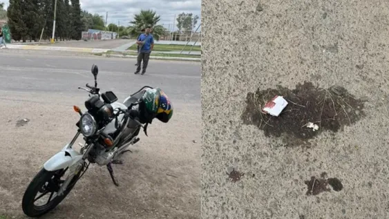 La atropelló una moto, ingresó con una quebradura expuesta de cadera y murió: tenía 79 años