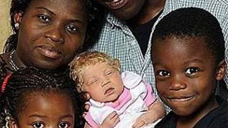 Nigerianos tuvieron una beba rubia