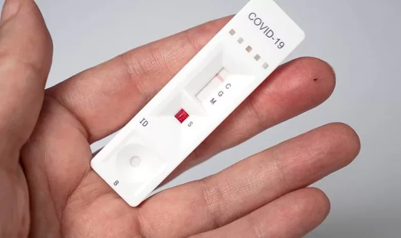 Los primeros autotest de covid estarían en la farmacias la próxima semana: cuánto saldrán