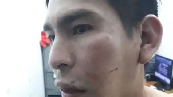 Le pegó a su hermana, el resto de la familia lo redujo a golpes y lo mandó al hospital