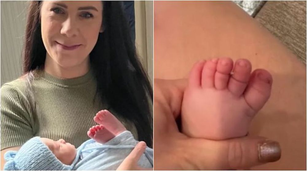 Un bebé de cinco meses casi pierde sus dedos del pie por un impensado accidente doméstico