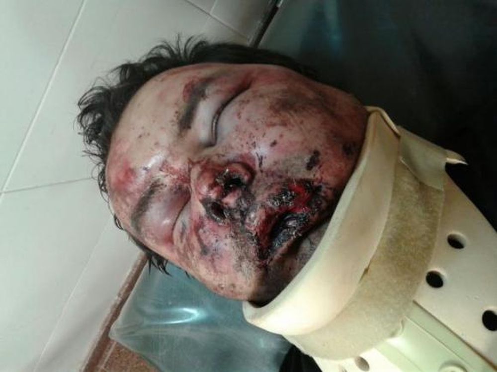 Le molió la cara a golpes por haber chocado su auto