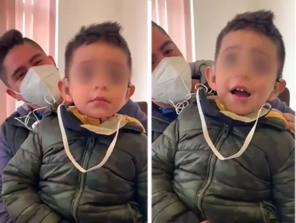 La reacción de un niño con discapacidad auditiva al escuchar por primera vez la voz de su padre