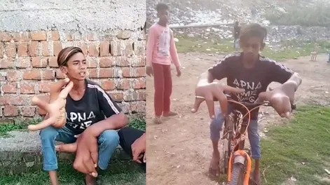 Los increíbles videos de un niño que tiene las manos gigantes