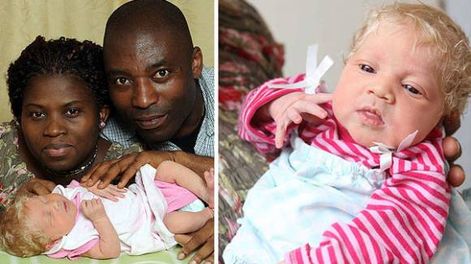 Son africanos y tuvieron una beba rubia y de ojos claros