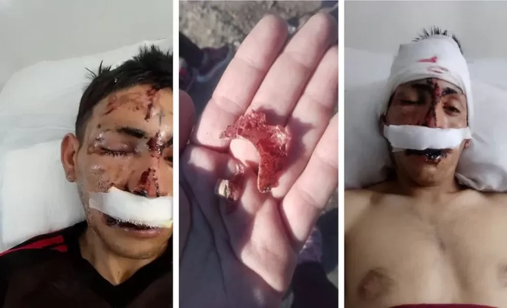 Salvaje ataque: dos hermanos golpearon a un joven hasta desfigurarlo frente a su hijo de 7 años