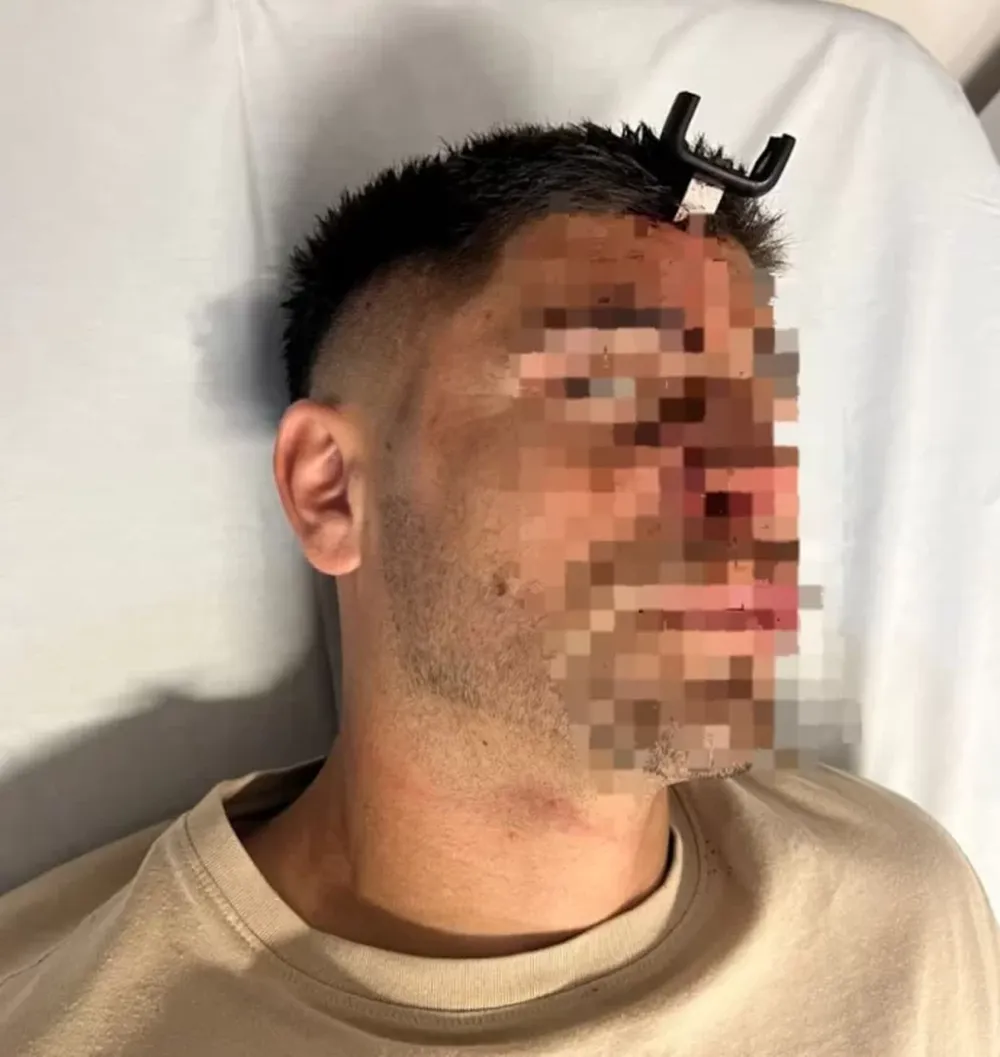 Conmoción en un partido de fútbol: en medio de una pelea, le clavaron una llave en la cabeza a un futbolista