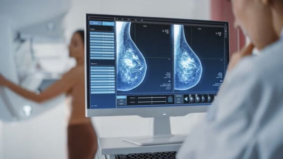 Cáncer de mama: cambian la edad en la que se debe hacer la primera mamografía