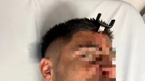 Jonathan Smith está recuperándose de la grave herida después de ser intervenido.