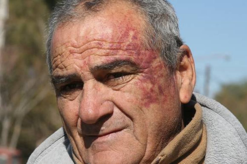 Brutal golpe a un sereno