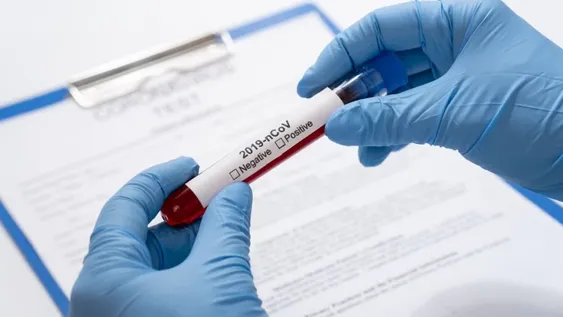Covid-19 en San Juan: hay 19 casos sospechosos en proceso de laboratorio