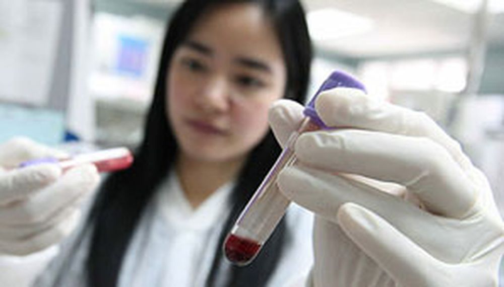 Crean un test que detecta el cáncer o VIH a simple vista
