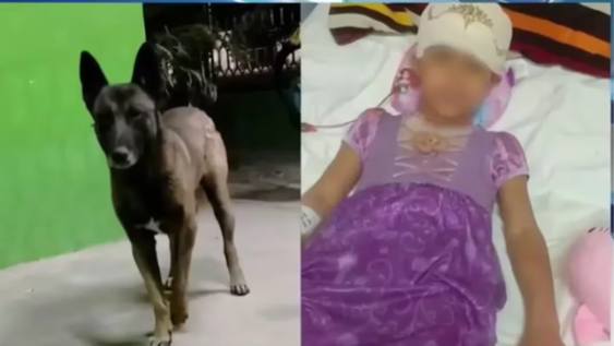 impactante video: el momento del feroz ataque de un perro a una nena cuando jugaban