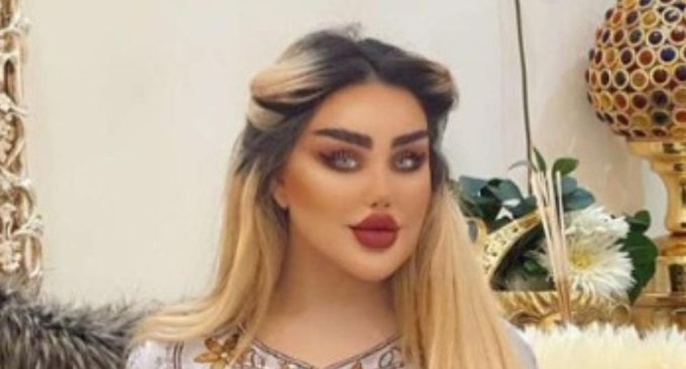 Quería parecerse a Barbie y gastó miles de dólares en 43 cirugías estéticas