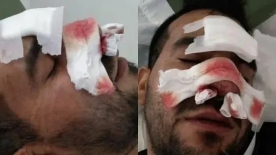 Denunció que patovicas le dieron una paliza a un joven en un boliche y lo dejaron inconsciente