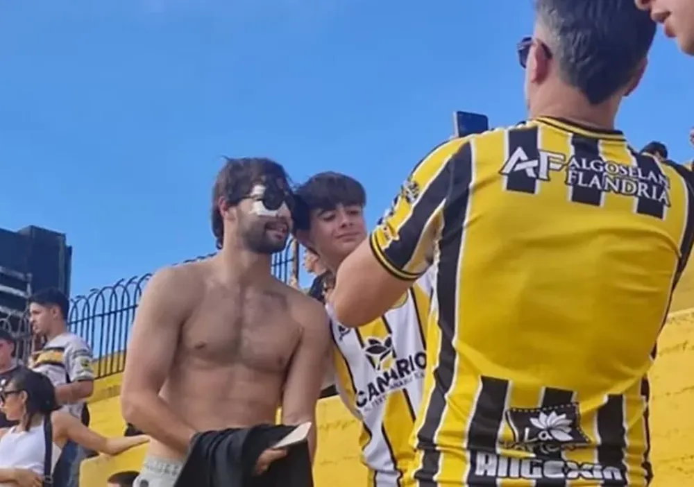 Santiago Sosa mostró cómo quedó su rostro tras la operación por la fractura que sufrió por un golpe de Marcos Rojo