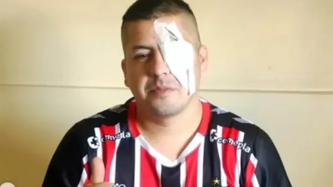 Un hincha denunció a Patricia Bullrich tras perder un ojo por la represión en el Congreso