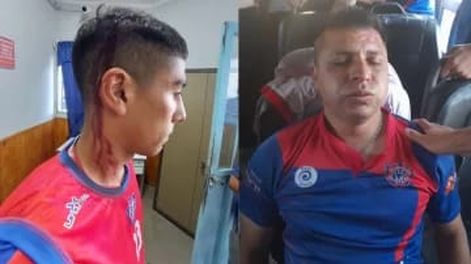 Citaron a declarar a jugadores de Villa Hipódromo tras las agresiones en la cancha de Del Bono