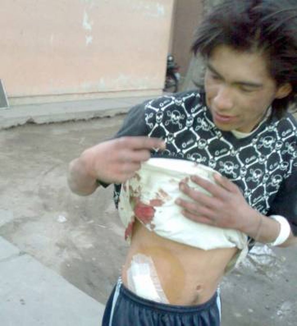 Por evitar robo, le dieron 2 puntazos