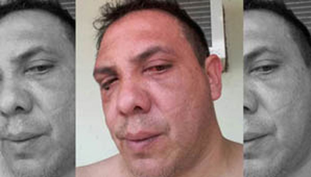 El “bolichero” se defiende: asume la falta pero dice que un grupo de policías lo golpearon