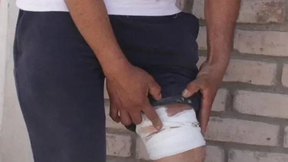 Dos heridos de arma de fuego en distintas grescas, casi en paralelo