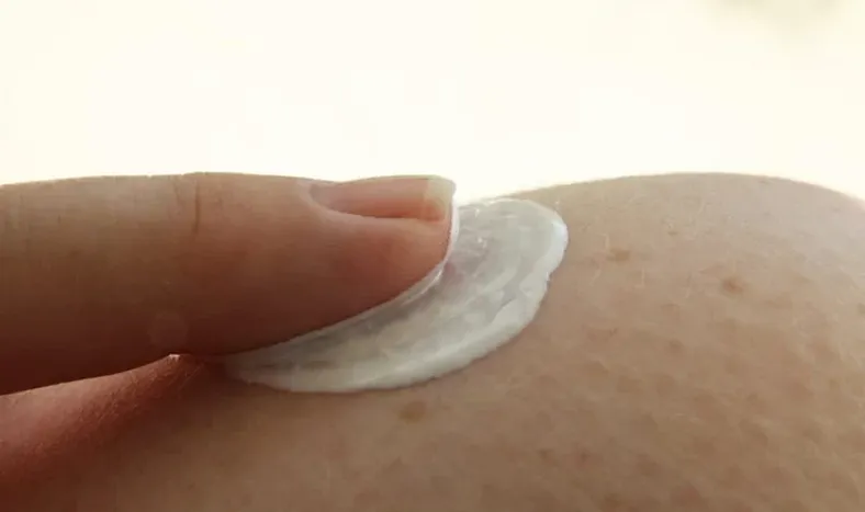 ANMAT prohibió una popular crema para combatir la dermatitis de pañal