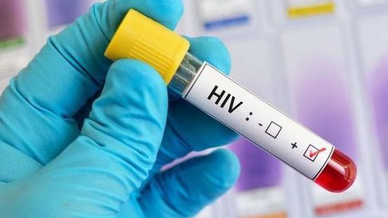 Tres de cada diez diagnósticos de HIV llegan en forma tardía