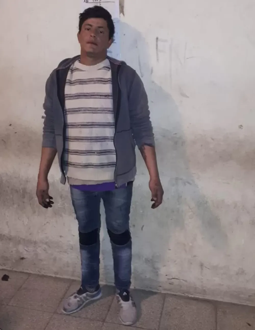 Una embarazada fue mordida y golpeada por su novio