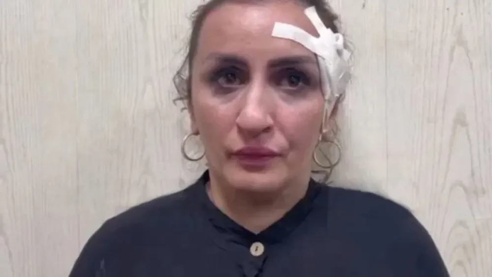 Detuvieron a la mujer que vendió a su bebé recién nacido para pagarse la operación de nariz