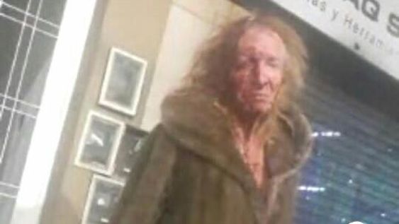 Violento asalto a Zulma Lobato: entraron en su casa y la golpearon brutalmente