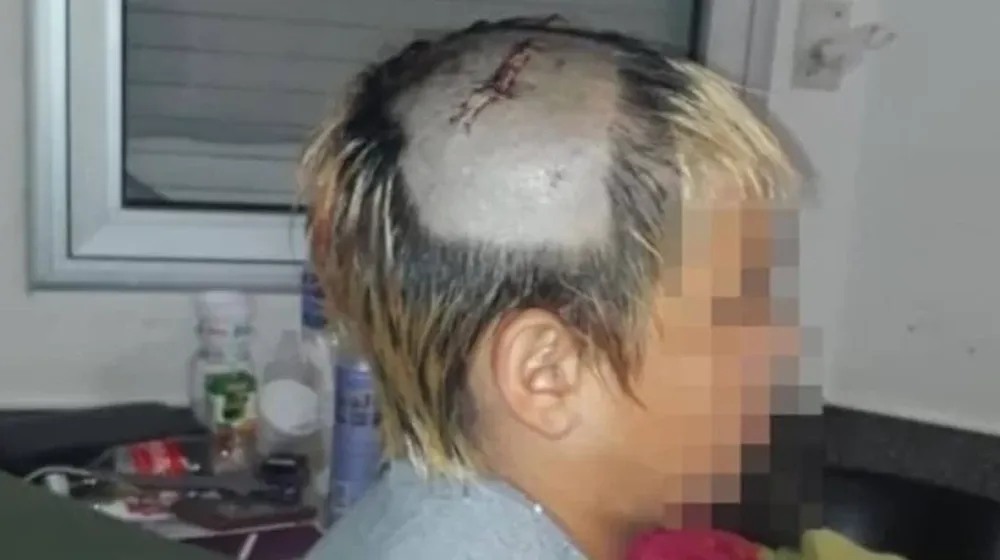 Detuvieron a 3 policías por golpear a nene de 10 años con una escopeta