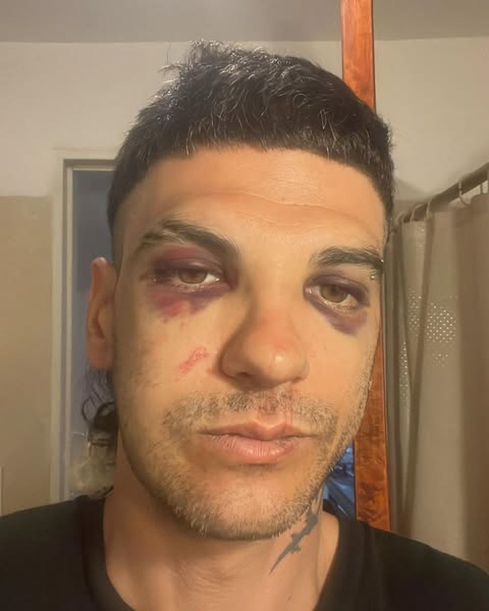 El empresario Juan Salvalaggio tras la golpiza.